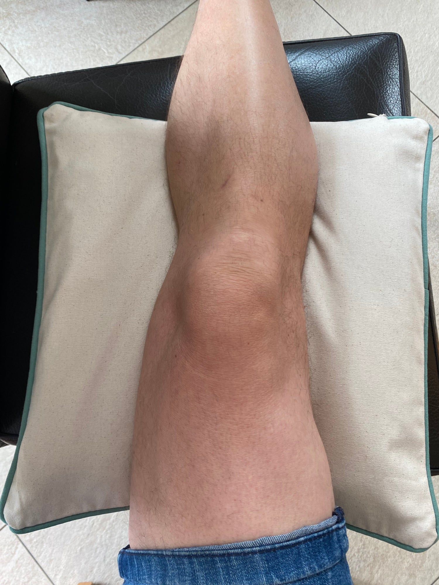 Orgon Kissen in der Anwendung (Knie)